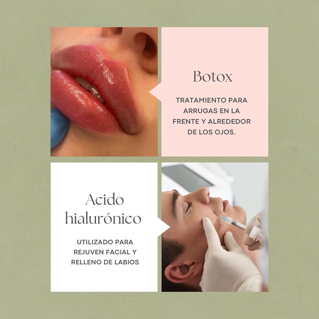 Procedimientos estéticos